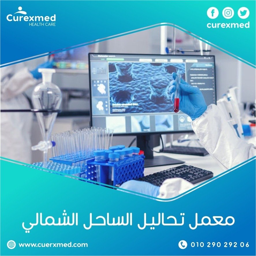 معمل تحاليل الساحل الشمالي